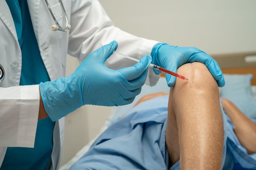 rio-orthopedic-sports-medicine-PRP-Therapy-vs-Surgery-For-Chronic-Tendonitis-Advanced-Non-Invasive-Healing rio-orthopedic-sports-medicine-PRP-Therapy-vs-Surgery-For-Chronic-Tendonitis-Advanced-Non-Invasive-Healing
